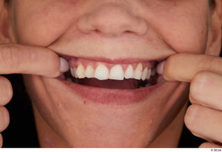 Sarah Kay teeth 0002.jpg
